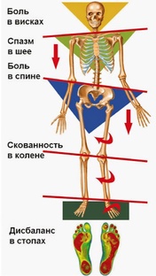 Пошаговый план восстановлению осанки