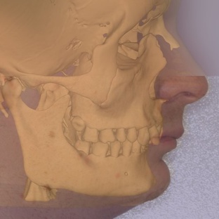 Ортогнатическая хирургия