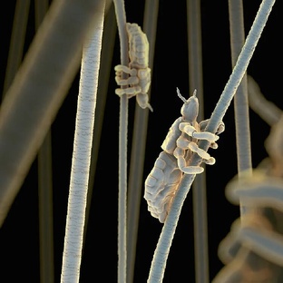 Вошь: крошечный паразит с огромным влиянием