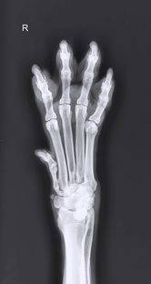 Рентгенологические укладки