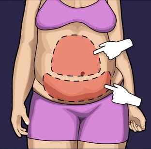 Знай базу, чтобы похудеть