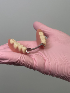 Съемные протезы