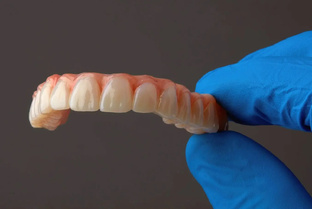 All-on-4: Полное восстановление улыбки на 4 имплантах