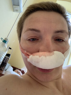 Операция на нос 