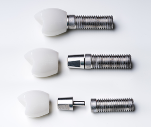 Имплантация