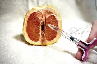 Посткоитальный цистит 