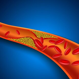 Холестерин+