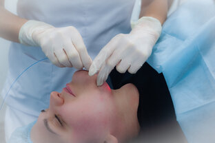 Лазерный эндолифтинг