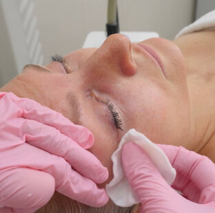 Кожа вокруг глаз