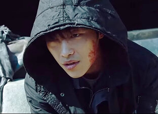 Ожог, ранимый псих с заточкой, но у него есть все основания!