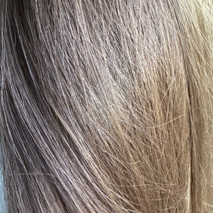 Борьба с выпадением волос