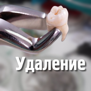 Удаление