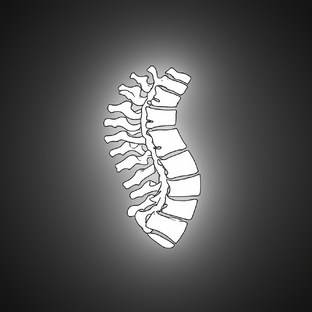 Нарушение Осанки и Сколиоз