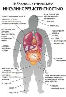 Инсулинорезистентность