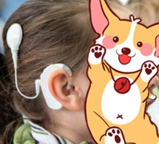 Ки, (Кохлеарная имплантация) 