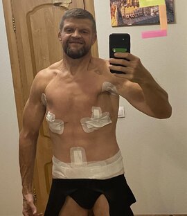 Пластическая операция
