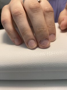 Такие ногти нельзя сделать красивыми