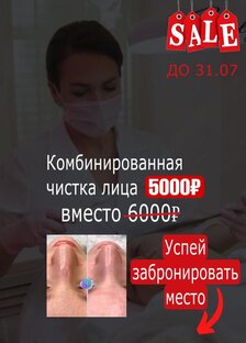 АКЦИИ ‼️