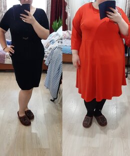 Про похудение и операцию