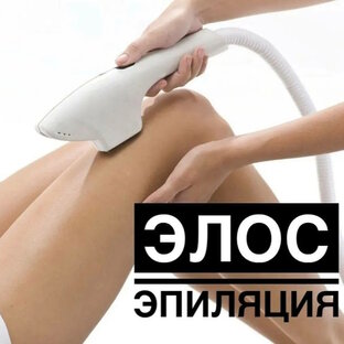 Элос-эпиляция
