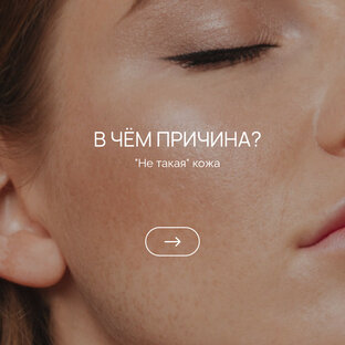 "Не такая" кожа