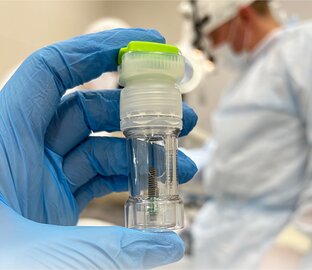 Имплантация