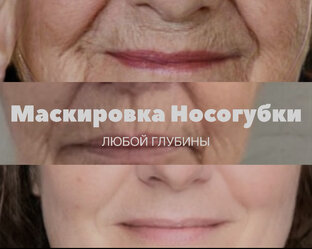 Маскировка Носогубки Любой Глубины