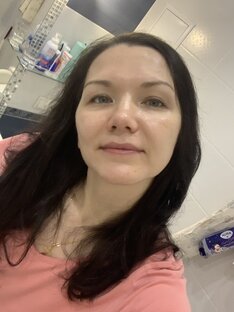 Как я ставила себе российский ботокс