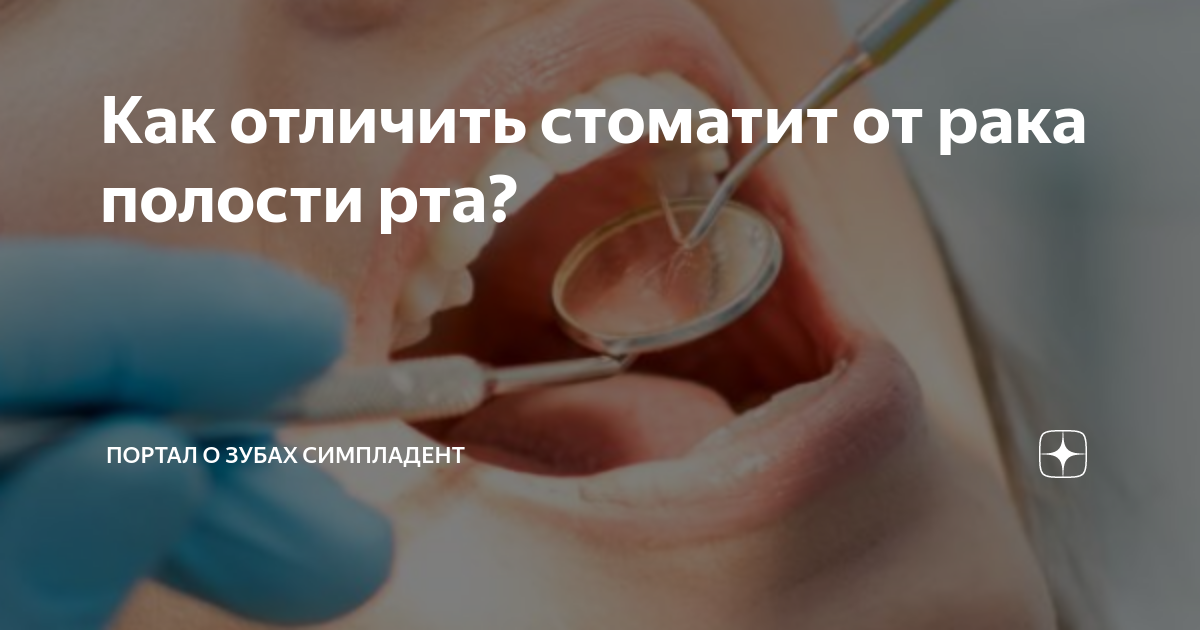 Как отличить стоматит от рака полости рта? | Портал о зубах Симпладент ...