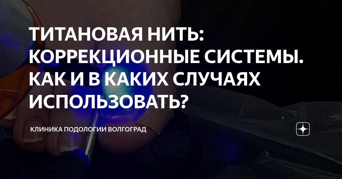 ТИТАНОВАЯ НИТЬ: КОРРЕКЦИОННЫЕ СИСТЕМЫ. КАК И В КАКИХ СЛУЧАЯХ ...