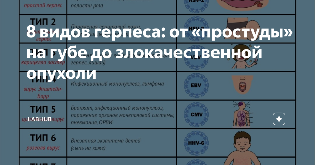 Герпес 4 типа у детей (90 фото)