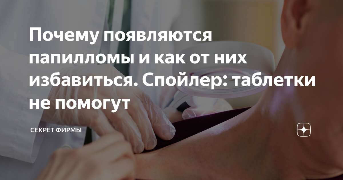 Почему появляются папилломы и как от них избавиться. Спойлер: таблетки ...