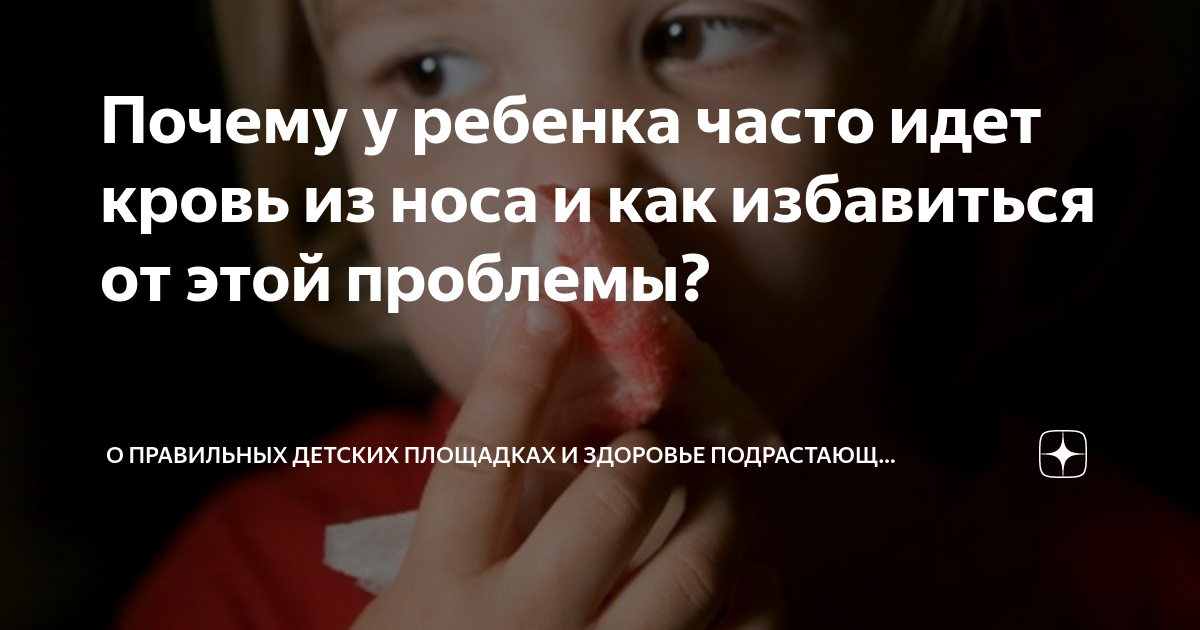 Кровь из носа у ребенка: как остановить кровотечение