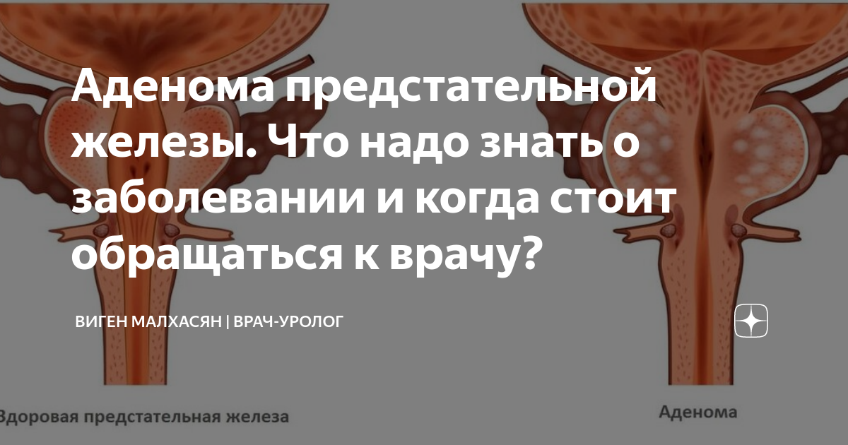 К какому врачу обращаться при простатите: урологу или андрологу?