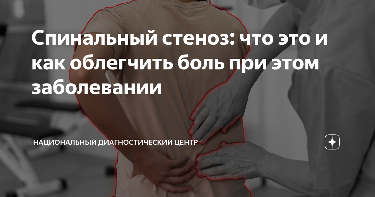 Спинальный стеноз: что это и как облегчить боль при этом заболевании ...