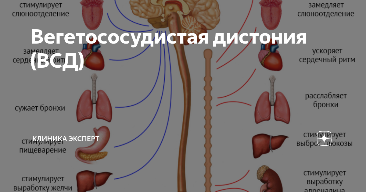Вегетососудистая дистония (ВСД) | Клиника ЭКСПЕРТ - Гастро-гепатоцентр ...