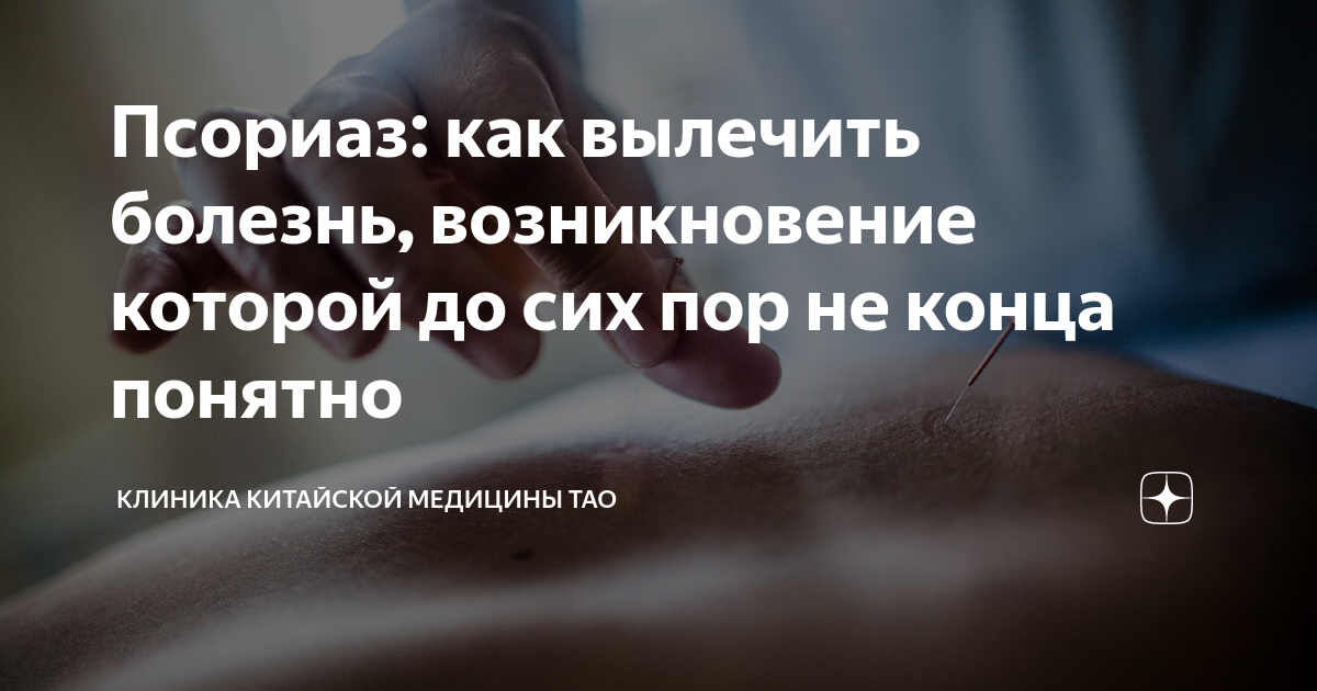 Псориаз: как вылечить болезнь, возникновение которой до сих пор не ...