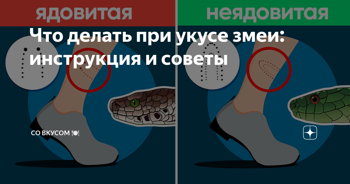 Что делать при укусе змеи: инструкция и советы | СО ВКУСОМ 🍽 | Дзен
