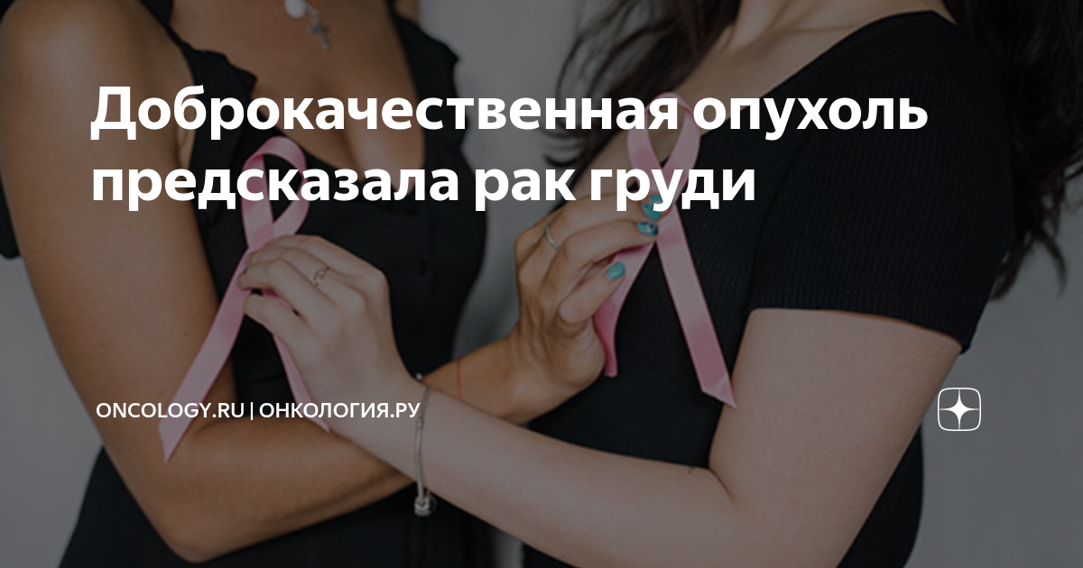 Доброкачественная опухоль предсказала рак груди | ONCOLOGY.ru ...