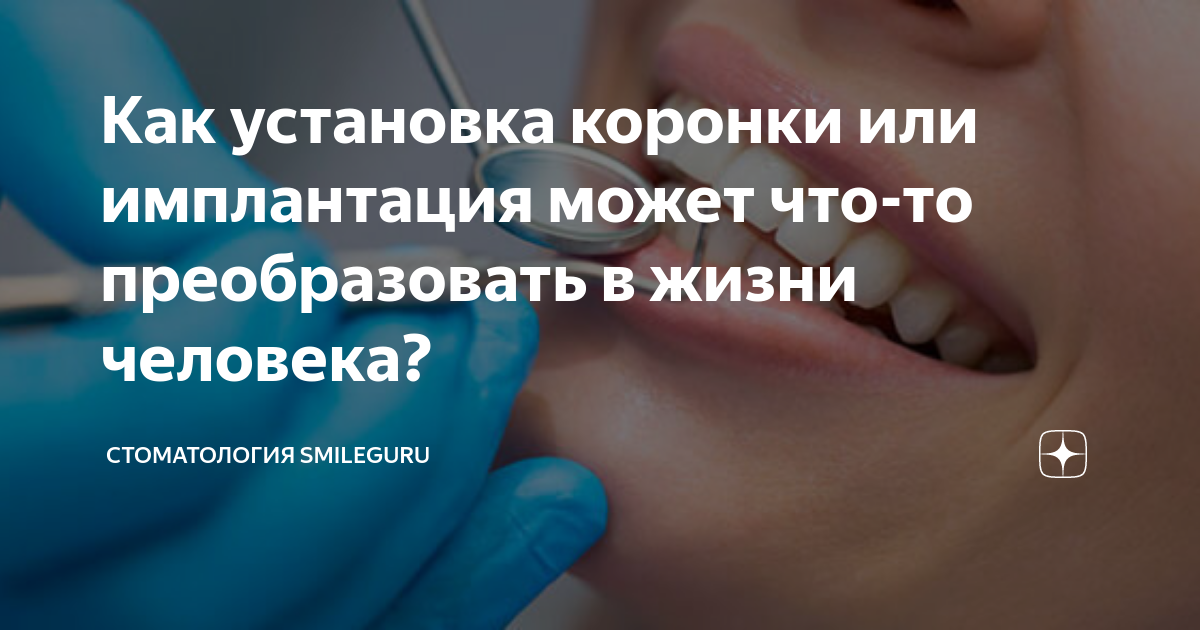 История имплантологии в стоматологии презентация