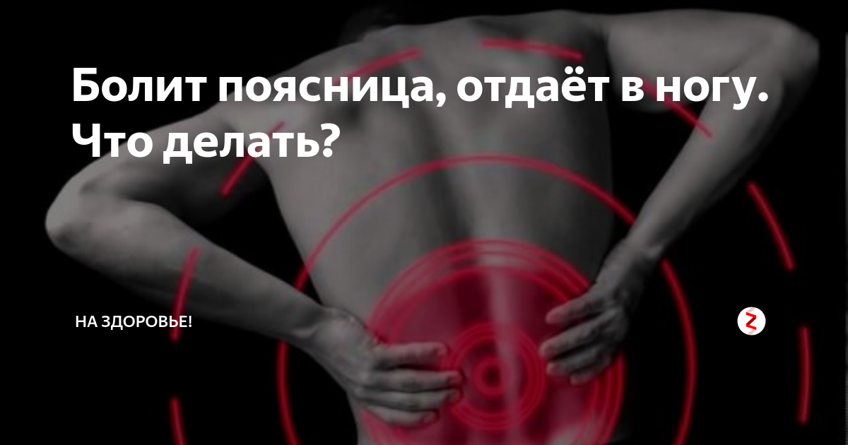Болит поясница отдает в ногу что это