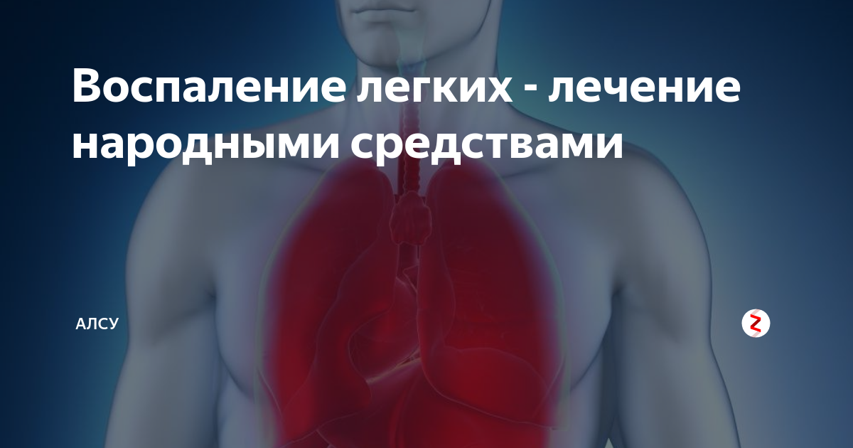 Воспаление лёгких народные средства. Народные средства от пневмонии легких. Воспаление лёгких лечение. Воспаление легких народные средства.