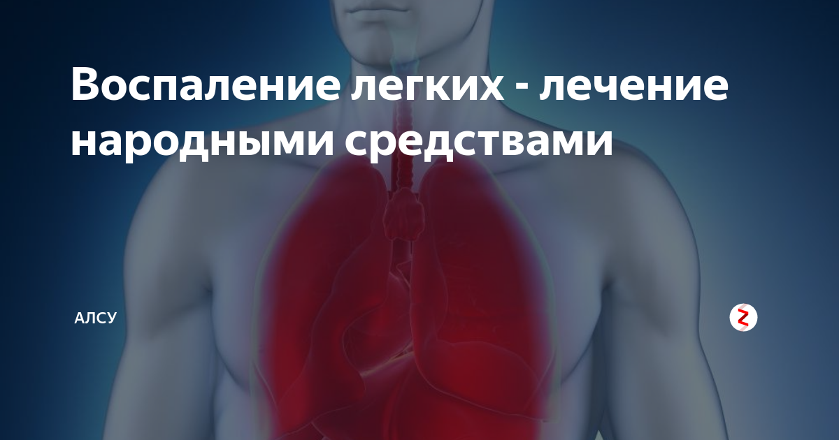 Народное лечение воспаление. Воспаление лёгких народные средства. Народные средства от пневмонии легких. Воспаление лёгких лечение. Воспаление легких народные средства.