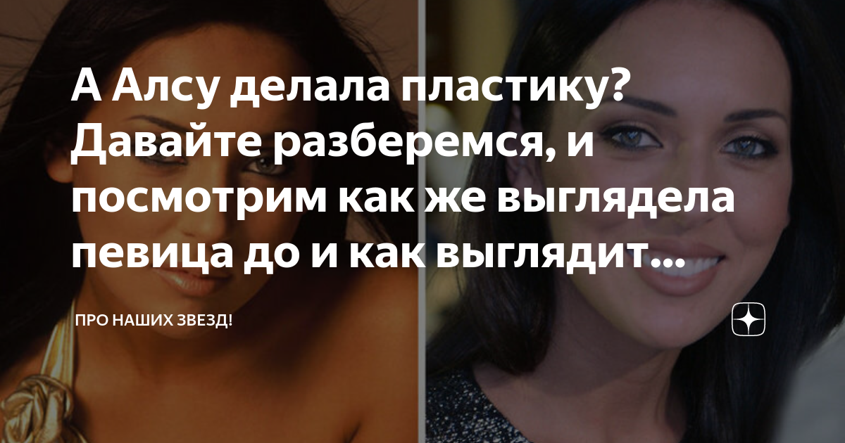 Из утёнка в лебедя! Как пластика до неузнаваемости изменила лицо Алсу