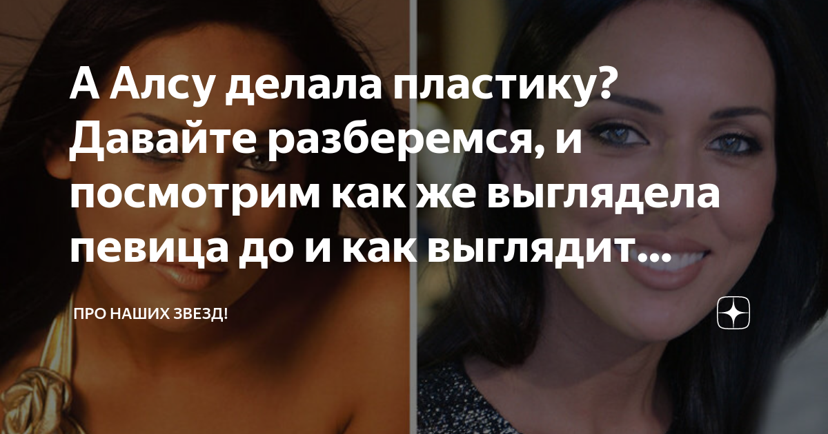 А Алсу делала пластику? Давайте разберемся, и посмотрим как же выглядела певица 