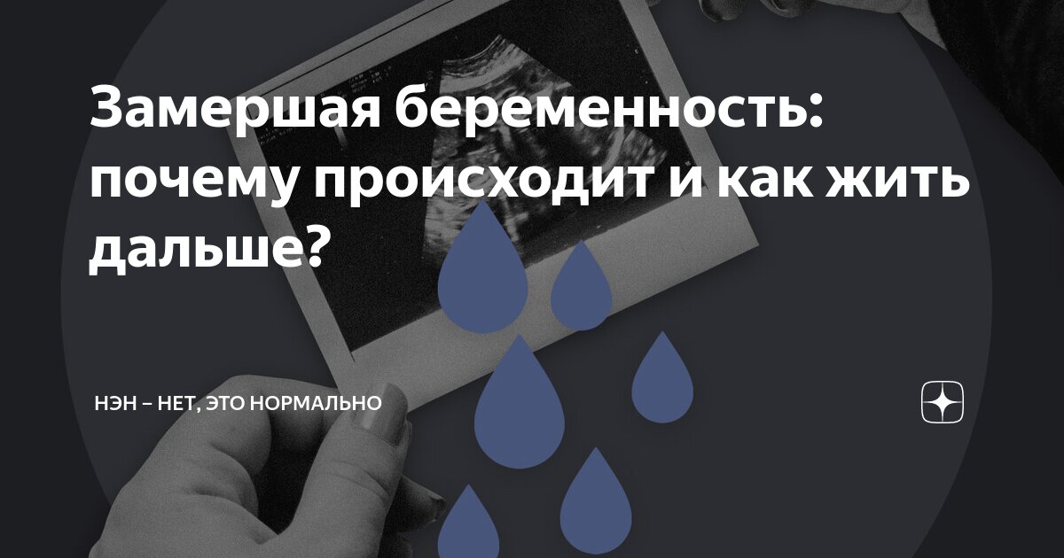 Замершая беременность: почему происходит и как жить дальше? | НЭН – Нет ...