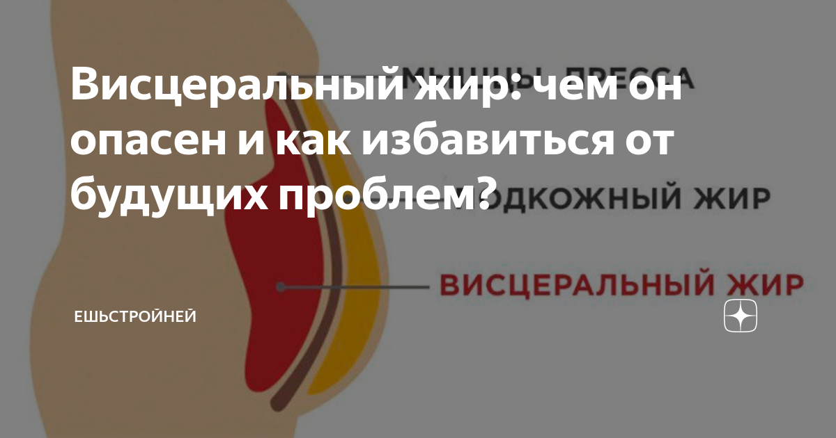 Как избавиться от висцерального жира у мужчин. Висцеральный жир как выглядит. Воспаление висцерального жира. Висцерального жира внутри организма.