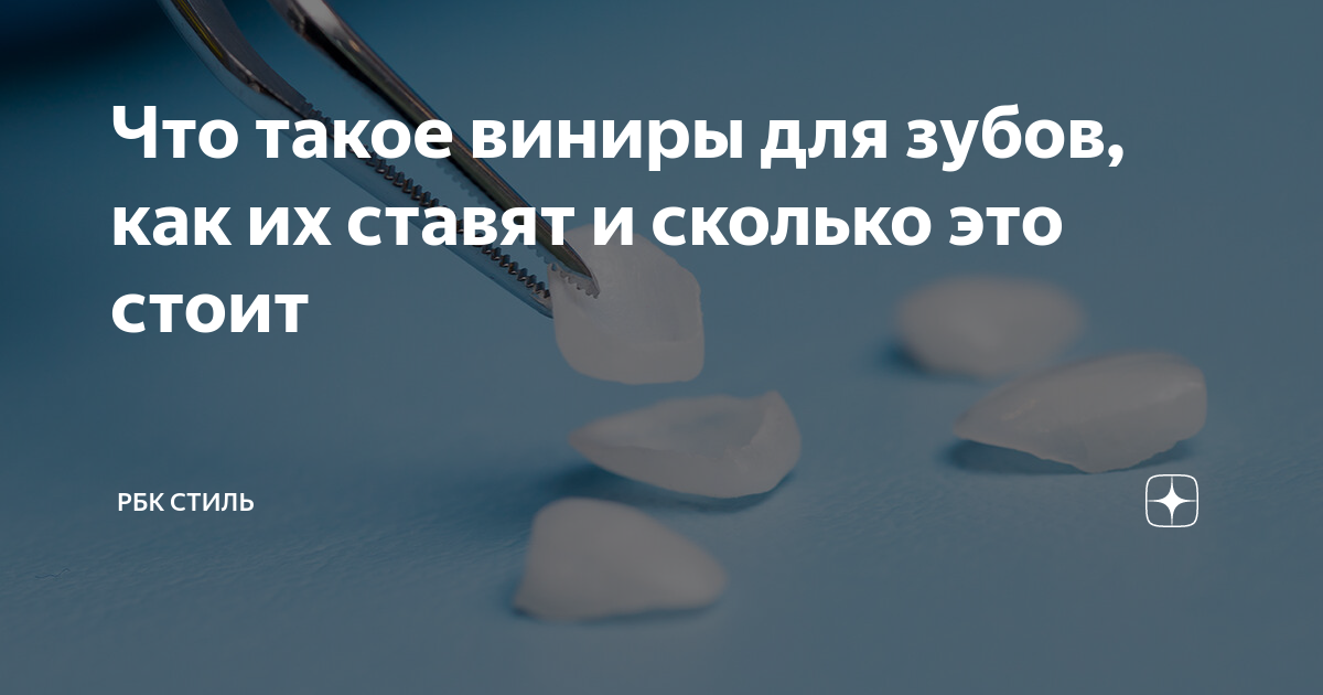 Что такое виниры для зубов, как их ставят и сколько это стоит | РБК ...