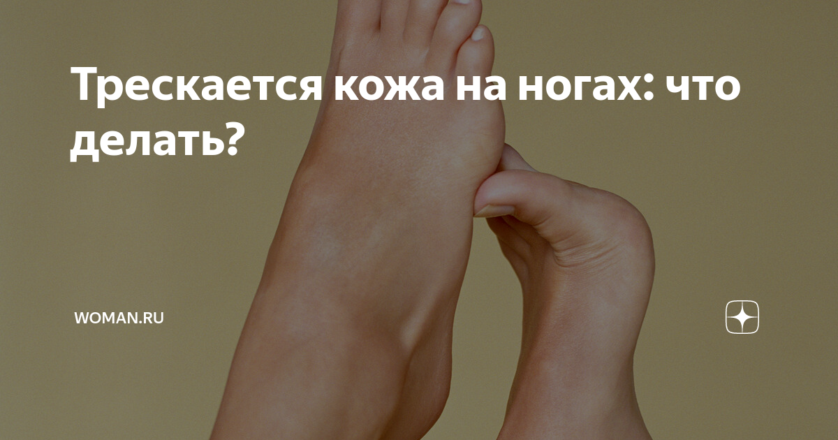 Трескается кожа на ногах: что делать? | Woman.ru | Дзен