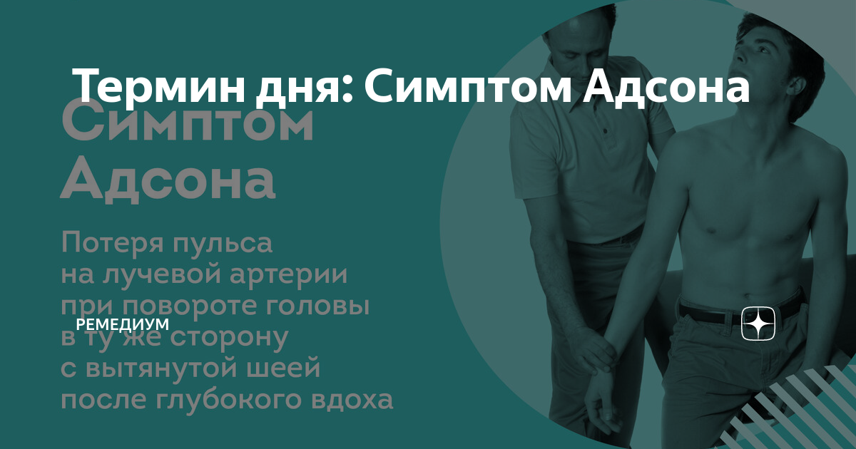 Термин дня: Симптом Адсона - что это такое?